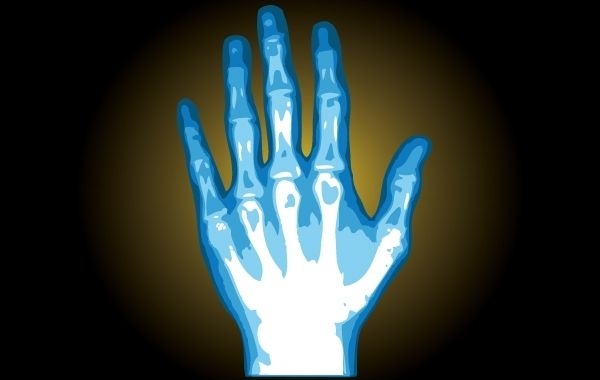 Ilustración de la mano de rayos X