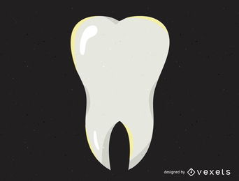 Tooth Illustration