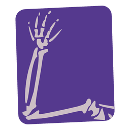Broken arm flat xray PNG Design
