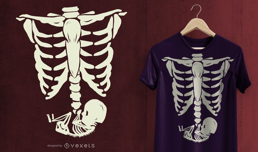 Pregnant X-Ray T-Shirt Design Pregnant X-Ray T-Shirt Design